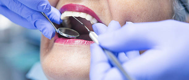 Best Emergency Treatment for Toothache in Bay Minette, AL